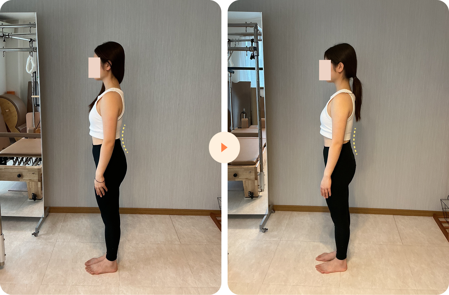 初回レッスン前後の姿勢の比較