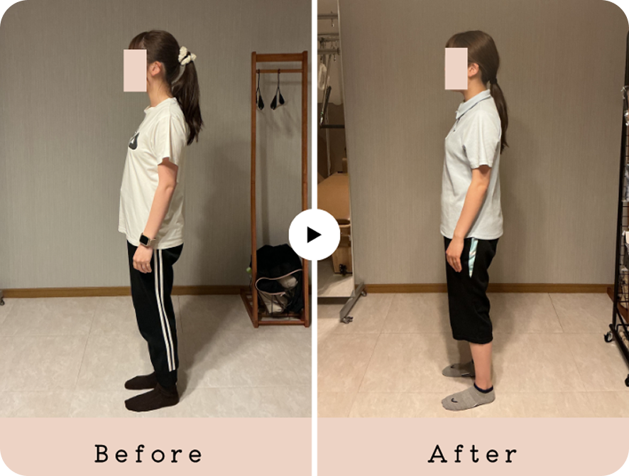 20代女性のレッスン前後の姿勢の比較