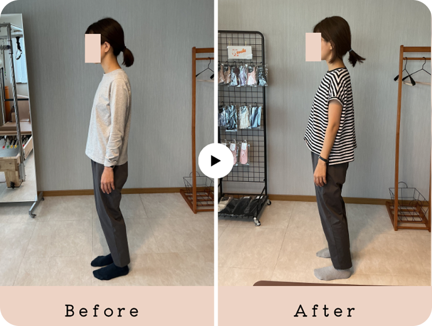 30代女性のレッスン前後の姿勢の比較