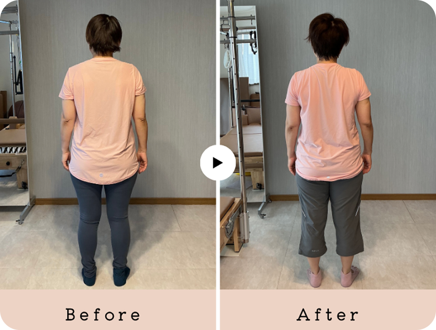 50代女性のレッスン前後の姿勢の比較